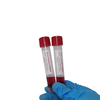 FDA 510 (k) Certifierad medicinsk biologisk disponibla virustransportmedia med swab